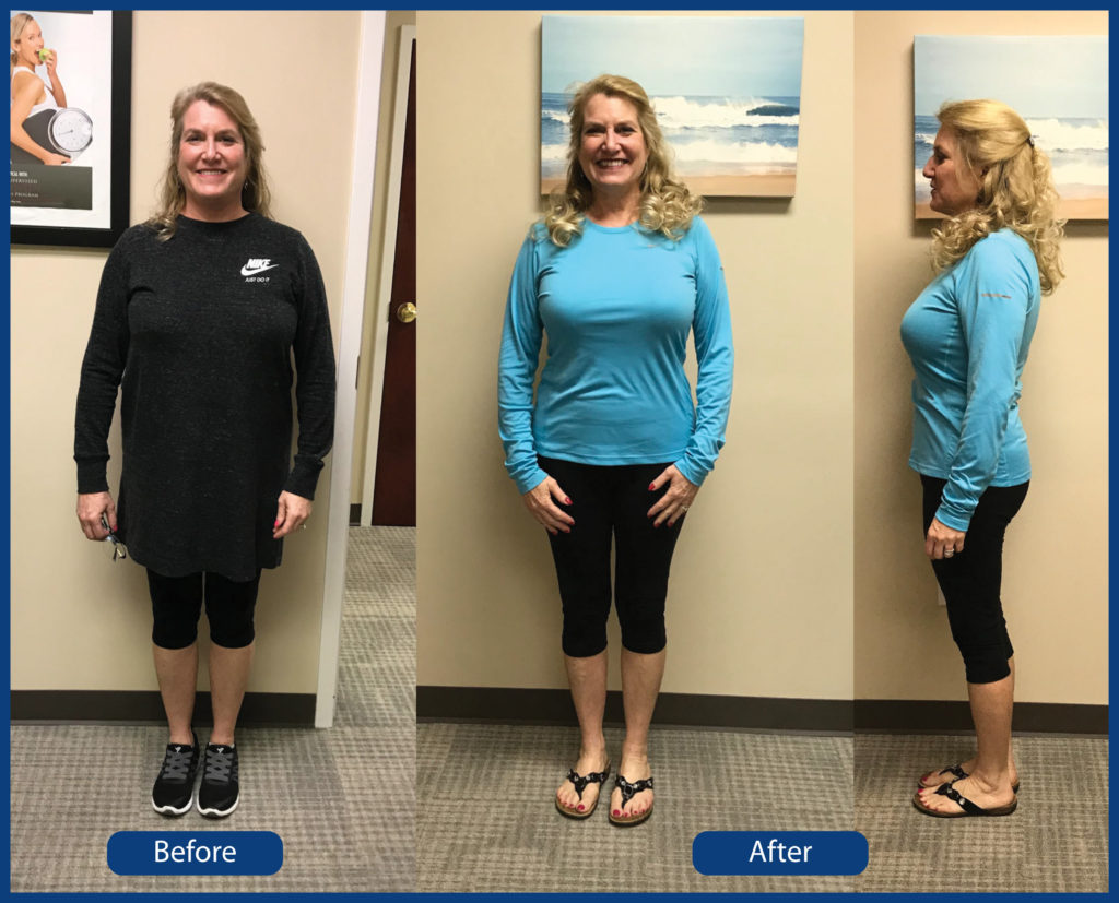 Amy's Weight Loss Results at Ballntyne Weight Loss Center in Charlotte Ballantyne Weight Loss Center at Gallagher Chiropractic and Wellness in Charlotte